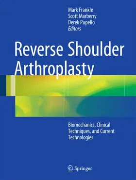 Frankle / Marberry / Pupello |  Reverse Shoulder Arthroplasty | eBook | Sack Fachmedien