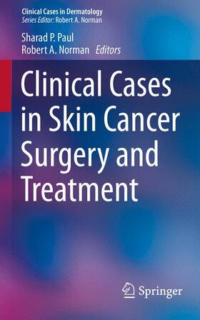 Paul / Norman | Clinical Cases in Skin Cancer Surgery and Treatment | Buch | 978-3-319-20936-4 | sack.de