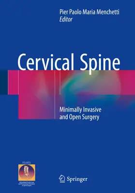 Menchetti |  Cervical Spine | eBook | Sack Fachmedien