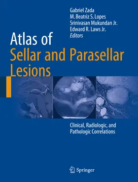 Zada / Lopes / Mukundan Jr. |  Atlas of Sellar and Parasellar Lesions | eBook | Sack Fachmedien