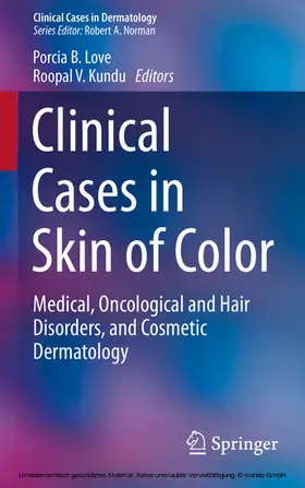Love / Kundu |  Clinical Cases in Skin of Color | eBook | Sack Fachmedien