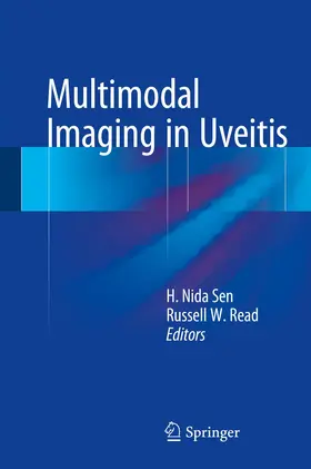 Sen / Read |  Multimodal Imaging in Uveitis | Buch |  Sack Fachmedien