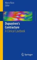 Rizzo |  Dupuytren¿s Contracture | Buch |  Sack Fachmedien