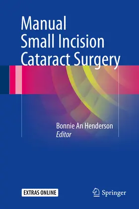 Henderson |  Manual Small Incision Cataract Surgery | eBook | Sack Fachmedien