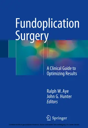 Aye / Hunter |  Fundoplication Surgery | eBook | Sack Fachmedien