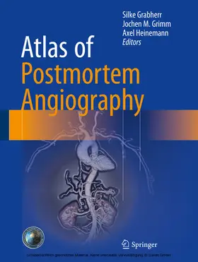 Grabherr / Grimm / Heinemann |  Atlas of Postmortem Angiography | eBook | Sack Fachmedien