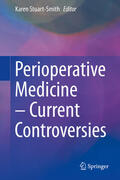 Stuart-Smith |  Perioperative Medicine – Current Controversies | eBook | Sack Fachmedien