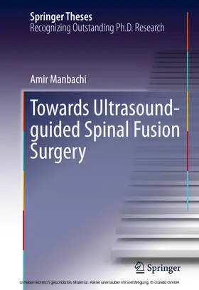 Manbachi |  Towards Ultrasound-guided Spinal Fusion Surgery | eBook | Sack Fachmedien