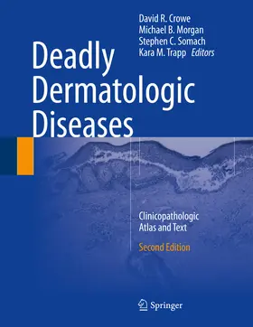 Crowe / Morgan / Somach |  Deadly Dermatologic Diseases | eBook | Sack Fachmedien