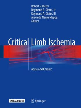 Dieter / Nanjundappa / Dieter, Jr | Critical Limb Ischemia | Buch | 978-3-319-31989-6 | sack.de