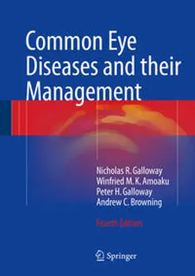 Galloway / Amoaku / Browning |  Common Eye Diseases and their Management | eBook | Sack Fachmedien