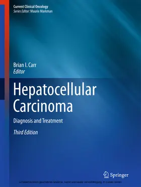 Carr |  Hepatocellular Carcinoma | eBook | Sack Fachmedien