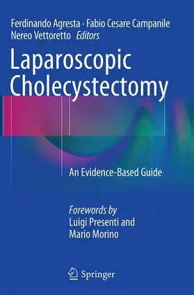 Agresta / Vettoretto / Campanile |  Laparoscopic Cholecystectomy | Buch |  Sack Fachmedien