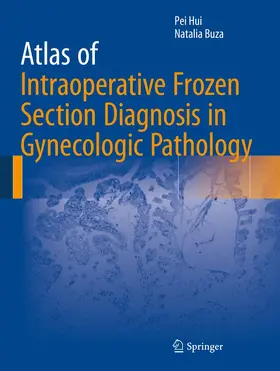 Buza / Hui |  Atlas of Intraoperative Frozen Section Diagnosis in Gynecologic Pathology | Buch |  Sack Fachmedien
