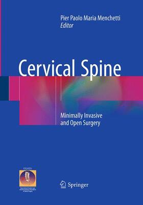 Menchetti | Cervical Spine | Buch | 978-3-319-36102-4 | sack.de