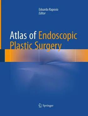 Raposio | Atlas of Endoscopic Plastic Surgery | Buch | 978-3-319-36916-7 | www.sack.de