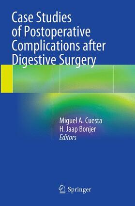 Bonjer / Cuesta | Case Studies of Postoperative Complications after Digestive Surgery | Buch | 978-3-319-37848-0 | sack.de