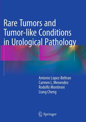 Lopez-Beltran / Cheng / Menendez | Rare Tumors and Tumor-like Conditions in Urological Pathology | Buch | 978-3-319-37871-8 | sack.de