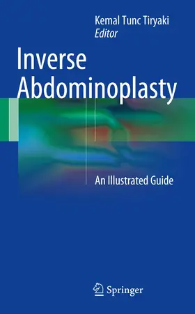 Tiryaki | Inverse Abdominoplasty | Buch | 978-3-319-39308-7 | www.sack.de