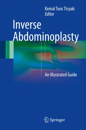 Tiryaki |  Inverse Abdominoplasty | eBook | Sack Fachmedien