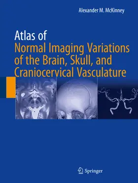 McKinney |  Atlas of Normal Imaging Variations of the Brain, Skull, and Craniocervical Vasculature | eBook | Sack Fachmedien