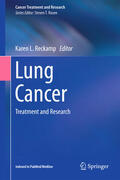 Reckamp |  Lung Cancer | eBook | Sack Fachmedien