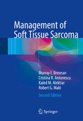 Brennan / Antonescu / Alektiar |  Management of Soft Tissue Sarcoma | eBook | Sack Fachmedien