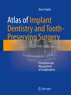 Stajcic / Stajcic | Atlas of Implant Dentistry and Tooth-Preserving Surgery | E-Book | sack.de