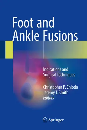 Chiodo / Smith |  Foot and Ankle Fusions | Buch |  Sack Fachmedien