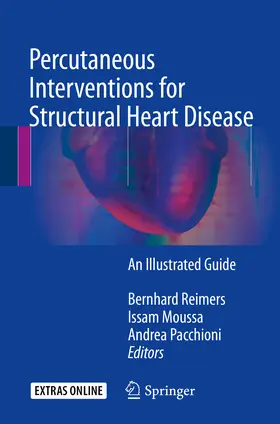 Reimers / Moussa / Pacchioni |  Percutaneous Interventions for Structural Heart Disease | eBook | Sack Fachmedien