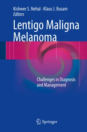 Nehal / Busam |  Lentigo Maligna Melanoma | eBook | Sack Fachmedien