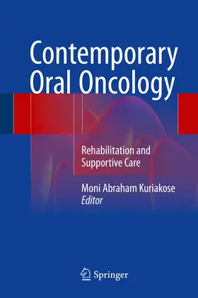 Kuriakose | Contemporary Oral Oncology | Buch | 978-3-319-43855-9 | www.sack.de