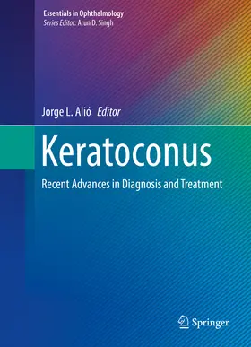 Alió |  Keratoconus | eBook | Sack Fachmedien