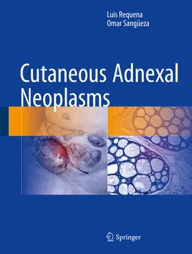 Requena / Sangüeza |  Cutaneous Adnexal Neoplasms | eBook | Sack Fachmedien