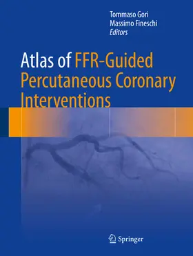 Gori / Fineschi | Atlas of FFR-Guided Percutaneous Coronary Interventions | E-Book | www.sack.de