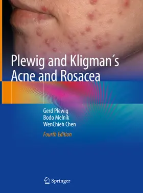 Plewig / Melnik / Chen |  Plewig and Kligman´s Acne and Rosacea | eBook | Sack Fachmedien
