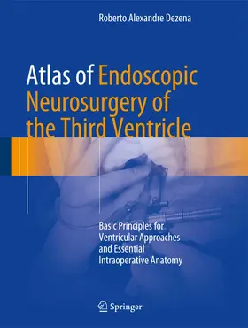 Dezena | Atlas of Endoscopic Neurosurgery of the Third Ventricle | Buch | 978-3-319-50067-6 | sack.de