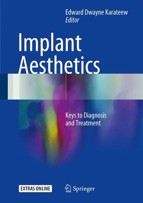 Karateew | Implant Aesthetics | Buch | 978-3-319-50704-0 | sack.de