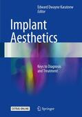 Karateew |  Implant Aesthetics | Buch |  Sack Fachmedien