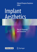 Karateew |  Implant Aesthetics | eBook | Sack Fachmedien