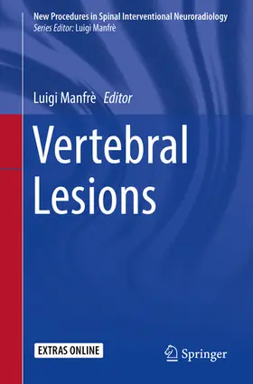 Manfrè |  Vertebral Lesions | eBook | Sack Fachmedien