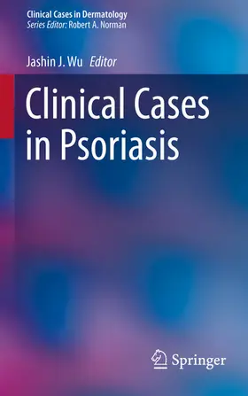 Wu |  Clinical Cases in Psoriasis | eBook | Sack Fachmedien