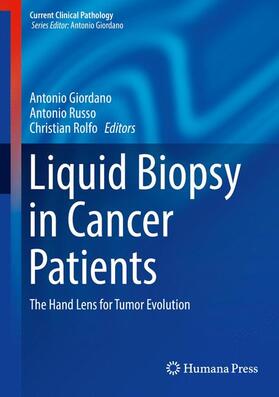 Russo / Giordano / Rolfo | Liquid Biopsy in Cancer Patients | Buch | 978-3-319-55659-8 | sack.de