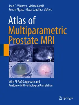 Vilanova / Catalá / Algaba |  Atlas of Multiparametric Prostate MRI | Buch |  Sack Fachmedien