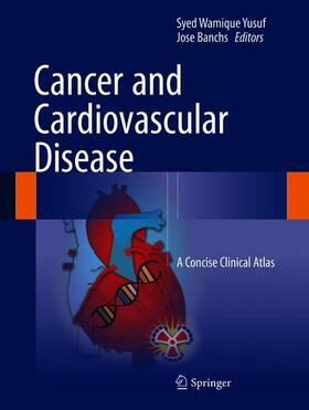 Banchs / Yusuf | Cancer and Cardiovascular Disease | Buch | 978-3-319-62086-2 | sack.de