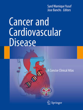 Yusuf / Banchs | Cancer and Cardiovascular Disease | E-Book | sack.de