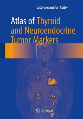 Giovanella | Atlas of Thyroid and Neuroendocrine Tumor Markers | Buch | 978-3-319-62505-8 | sack.de