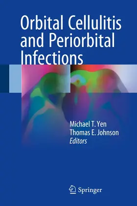 Yen / Johnson |  Orbital Cellulitis and Periorbital Infections | eBook | Sack Fachmedien