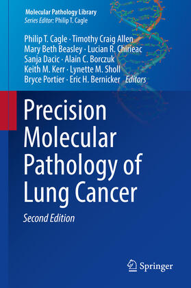 Cagle / Allen / Beasley | Precision Molecular Pathology of Lung Cancer | E-Book | sack.de