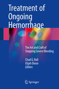 Ball / Dixon |  Treatment of Ongoing Hemorrhage | eBook | Sack Fachmedien